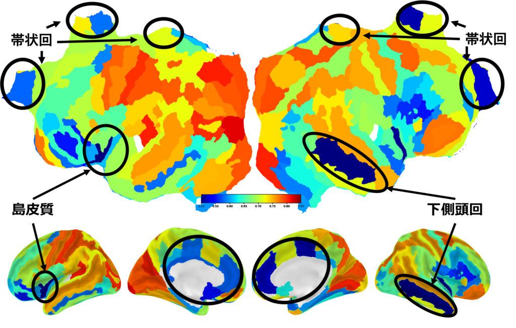 男女で相関が低くなった脳領域/Brain regions with low correlation between men and women